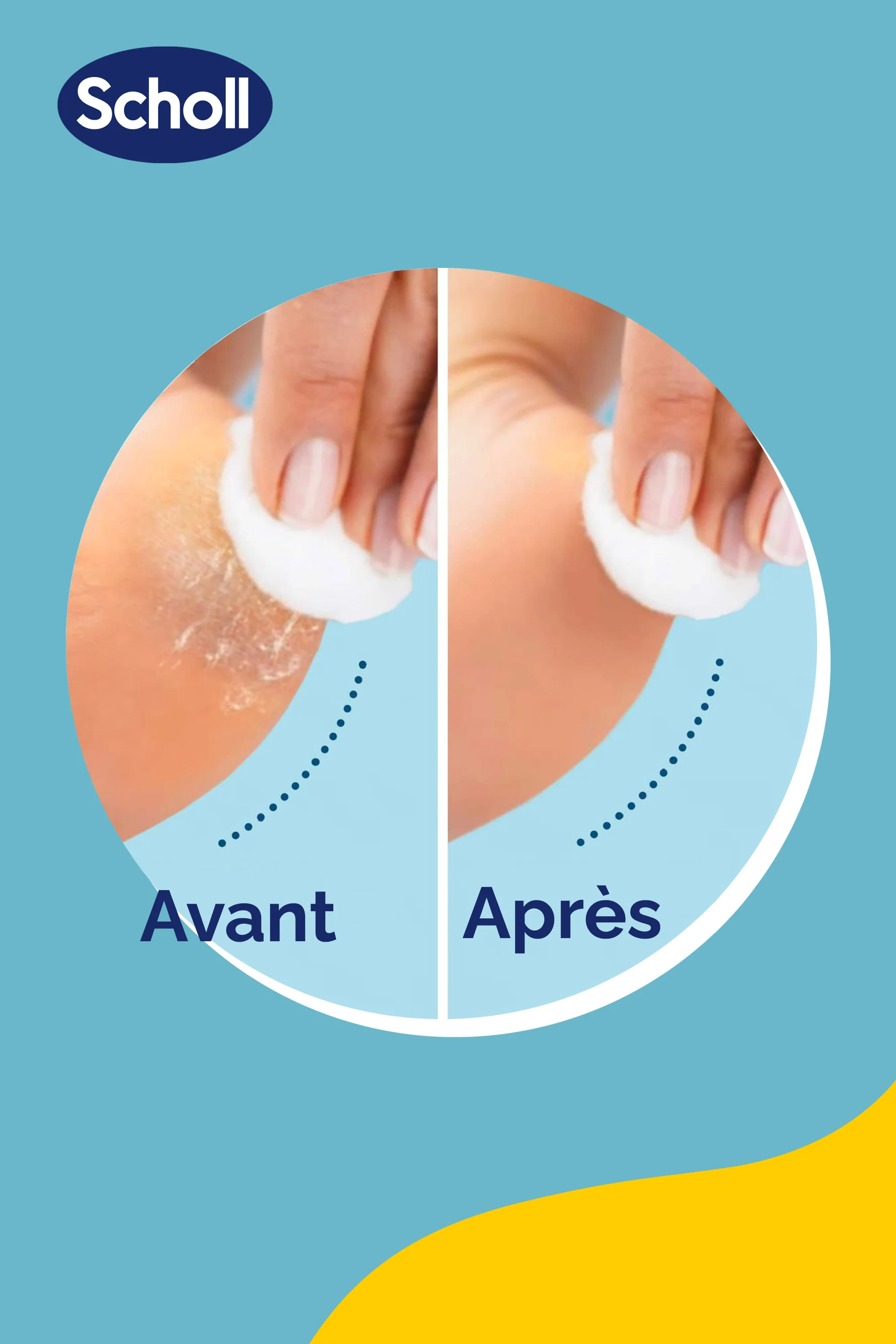 Rouleaux de Remplacement Scholl 2 en 1 Exfoliant & Lissant pour Râpe Electrique - Image 6